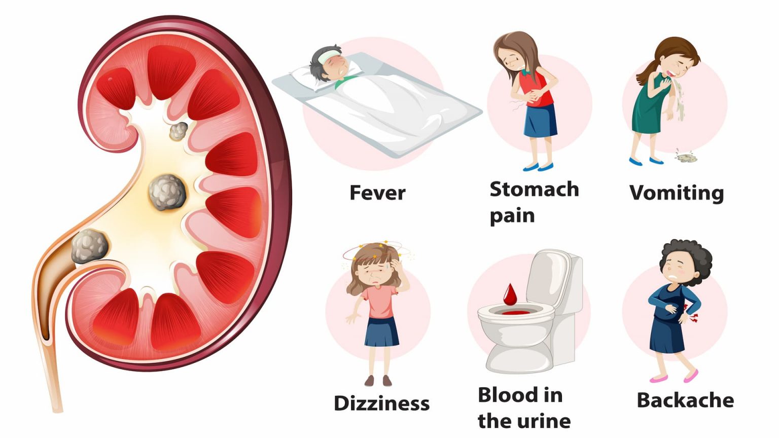 how-long-does-it-take-to-pass-a-kidney-stone-your-info-master