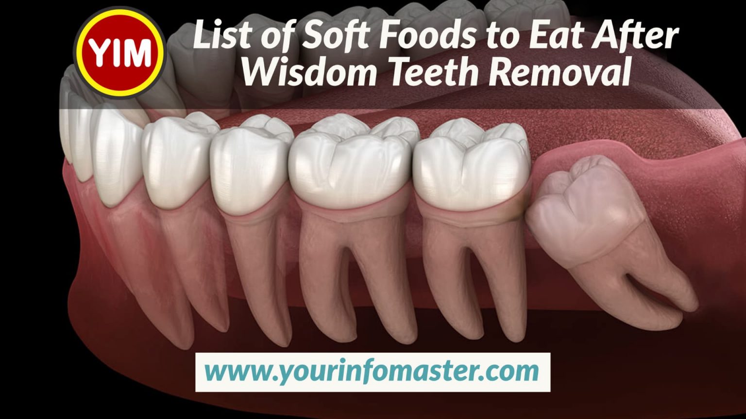 List of Soft Foods to Eat After Wisdom Teeth Removal Your Info Master