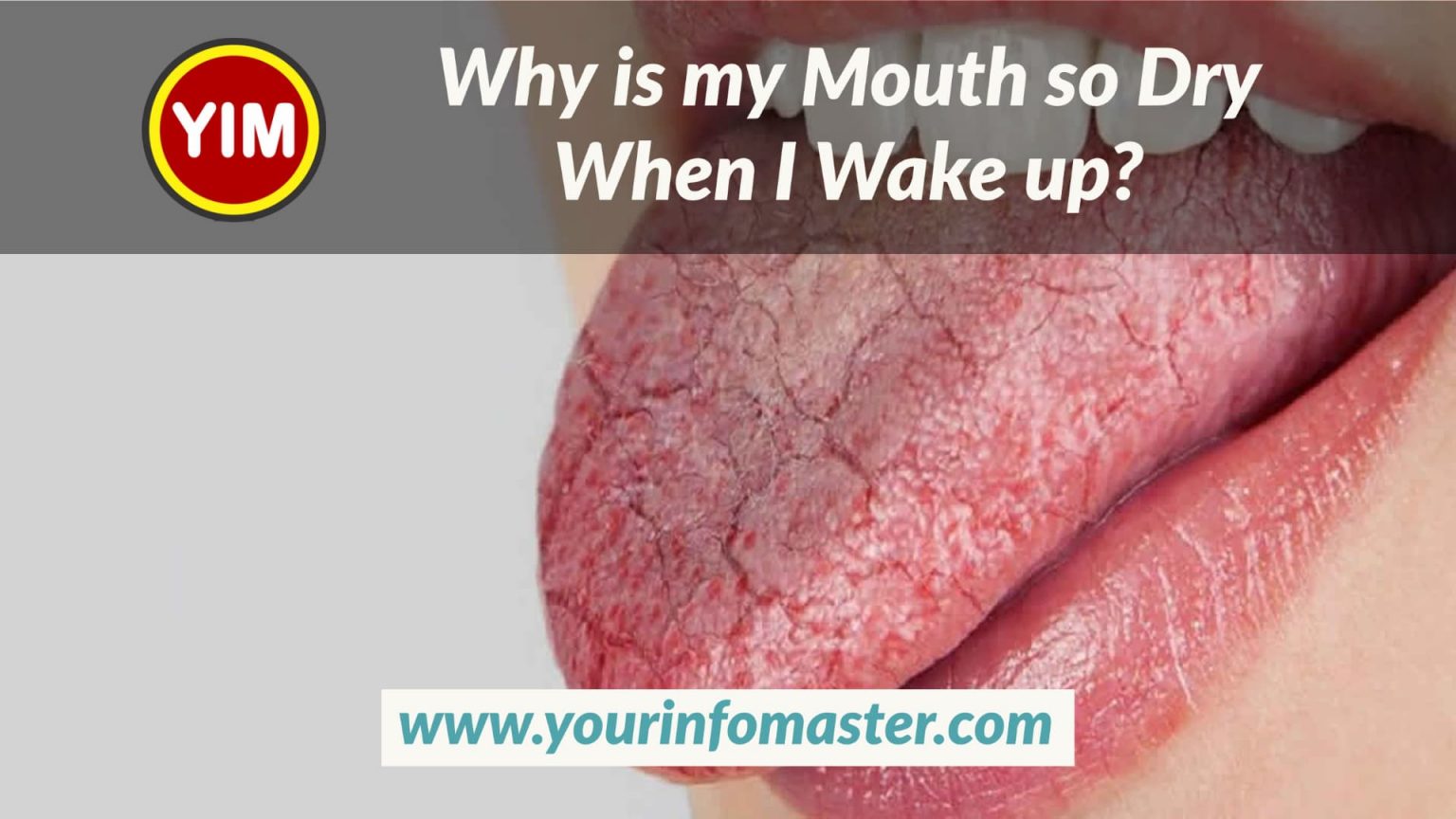 Why is my Mouth so Dry When I Wake up? Your Info Master