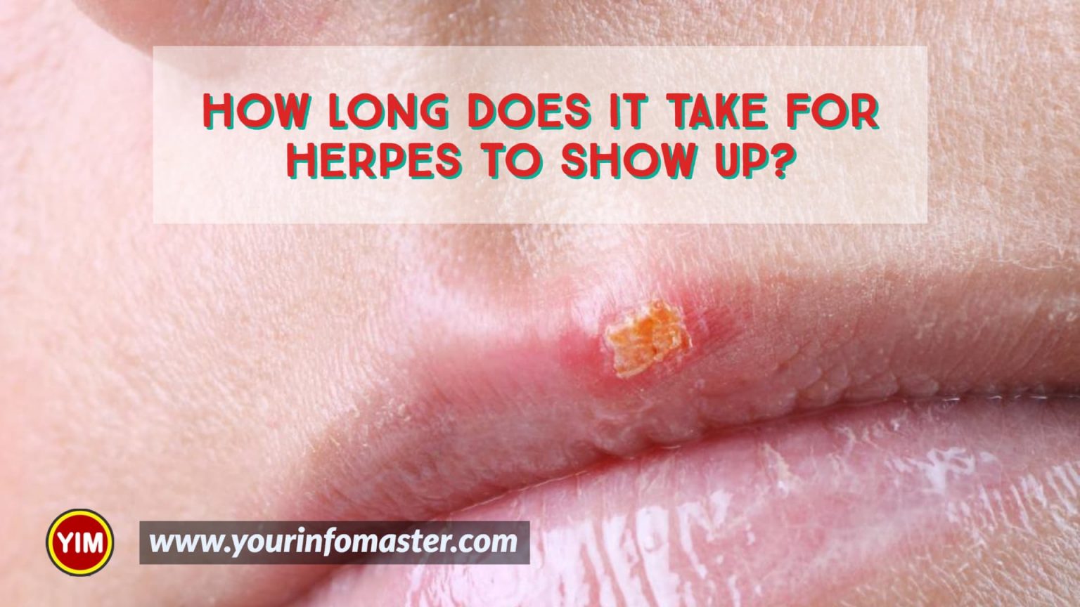 how-long-does-it-take-for-herpes-to-show-up-your-info-master